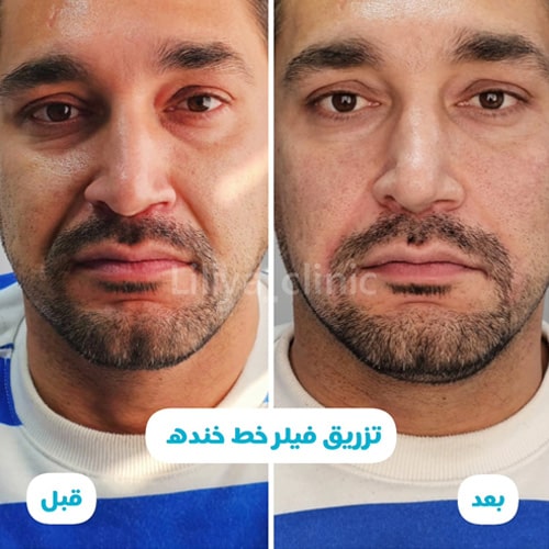 نمونه خدمات کلینیک زیبایی لیلیا