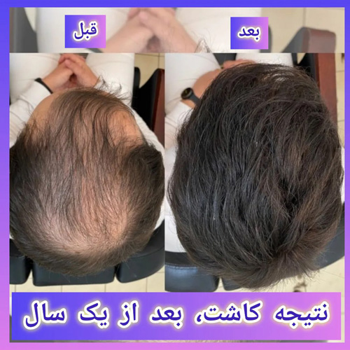 نمونه کار دكتر عليخانی