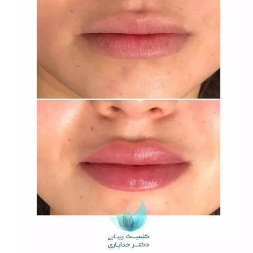نمونه کار دکتر خدایاری