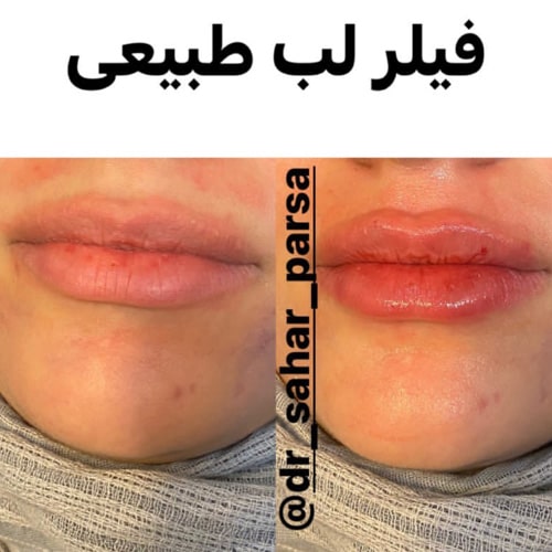نمونه کار دکتر سحر پارسا