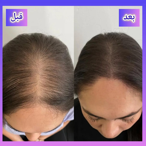 نمونه کار دكتر عليخانی