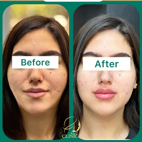 نمونه کار کلینیک زیبایی رازی