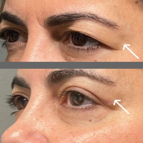 بهترین کلینیک زیبایی در پیروزی