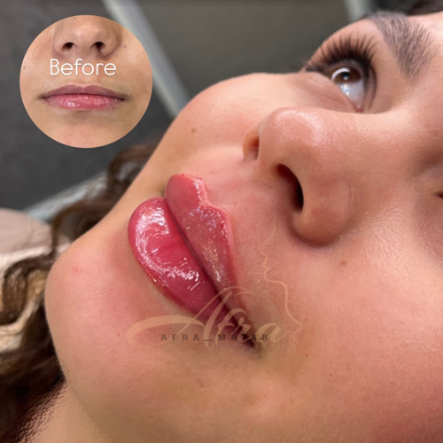 بهترین دکتر تزریق ژل در سعادت آباد