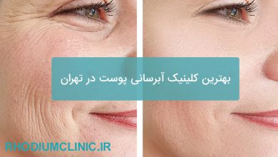 کلینیک آبرسانی پوست در تهران