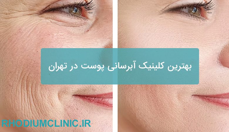کلینیک آبرسانی پوست در تهران