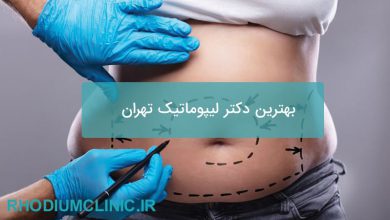 بهترین دکتر لیپوماتیک تهران