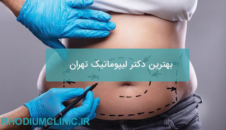 بهترین دکتر لیپوماتیک تهران