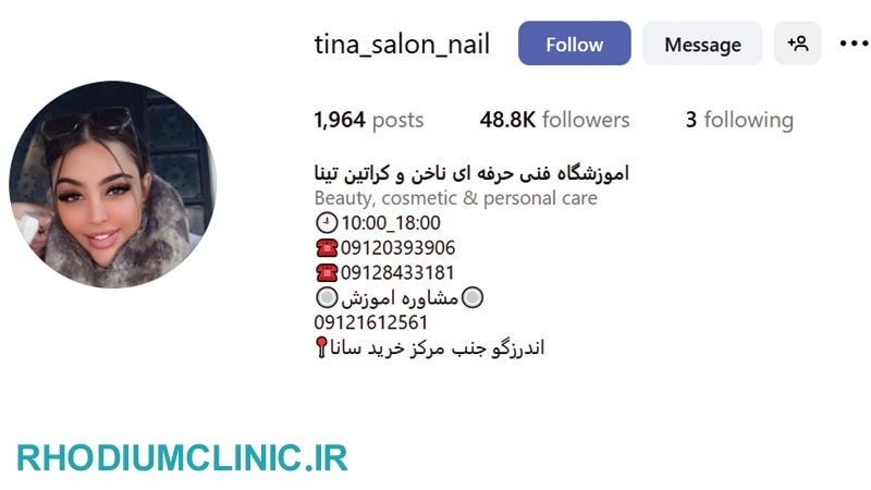 تینا، متخصص ترمیم ناخن اندرزگو