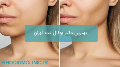 بهترین دکتر بوکال فت تهران