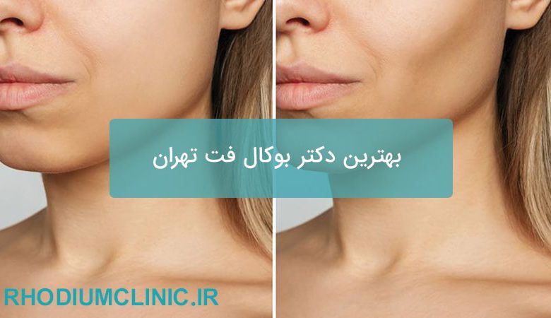 بهترین دکتر بوکال فت تهران