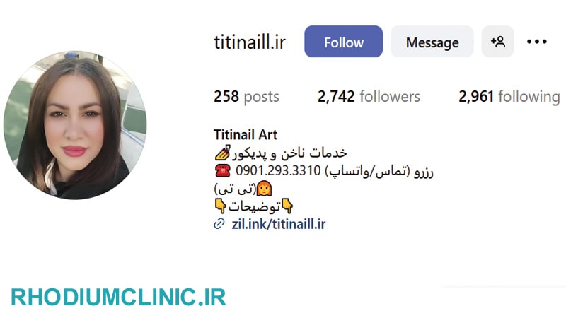 خدمات ناخن تی تی مهرشهر