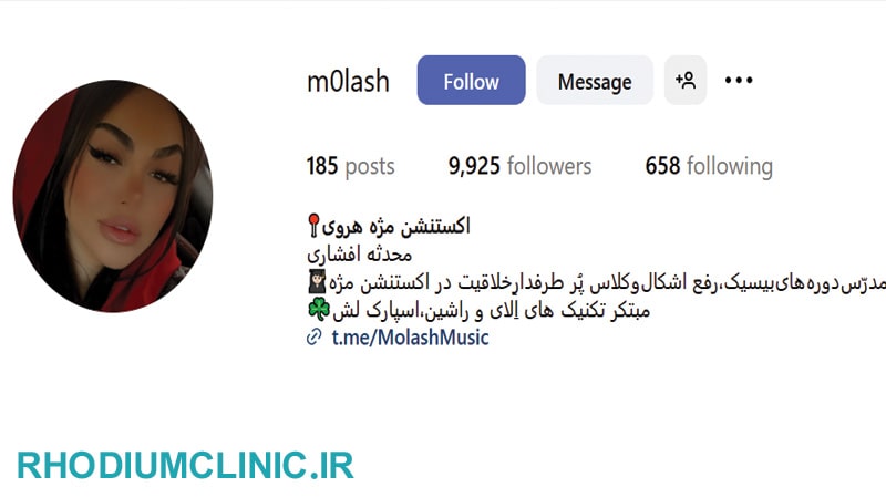 محدثه افشاری، مرکز کاشت مژه پاسداران