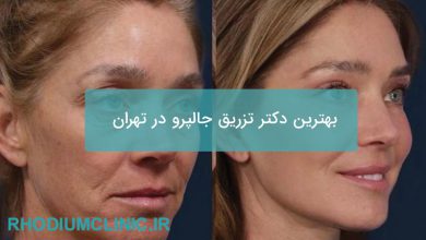تزریق جالپرو در تهران