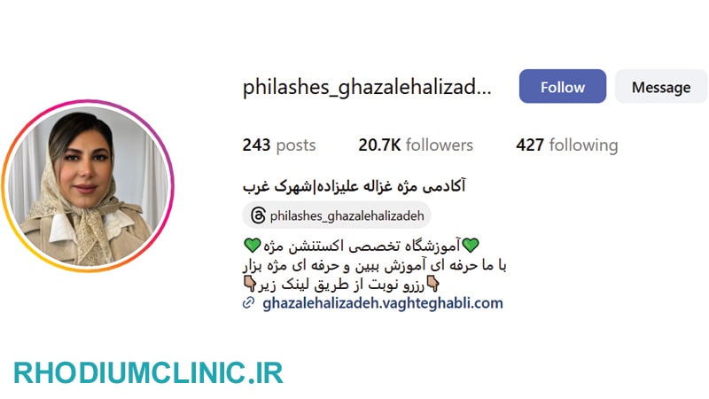 غزاله علیزاده، محبوب ترین مژه کار در شهرک غرب