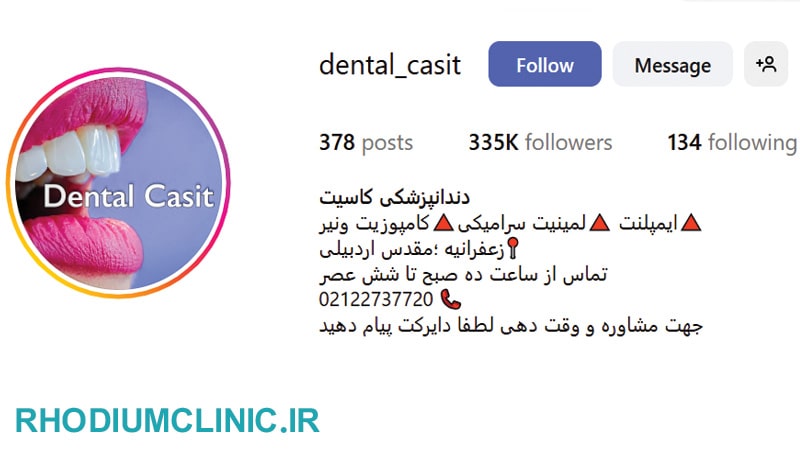 کاسیت، بهترین کلینیک دندانپزشکی در زعفرانیه