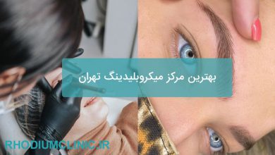 بهترین مرکز میکروبلیدینگ تهران