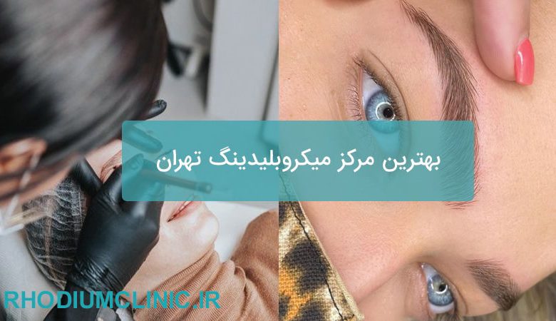 بهترین مرکز میکروبلیدینگ تهران