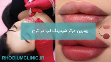 شیدینگ لب در کرج
