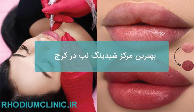 شیدینگ لب در کرج