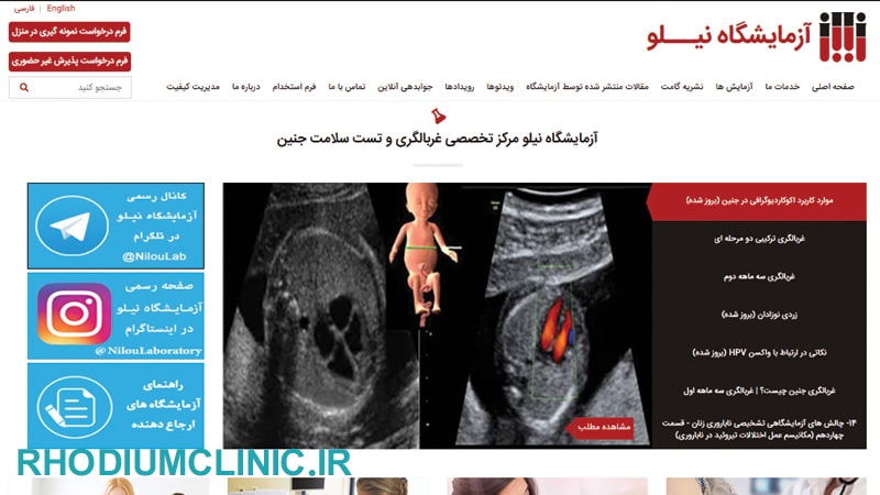 آزمایشگاه نیلو در تهران
