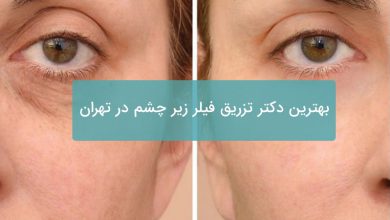 بهترین دکتر تزریق فیلر زیر چشم در تهران