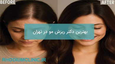 بهترین دکتر ریزش مو در تهران