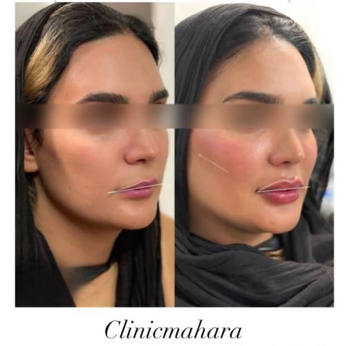 بهترین کلینیک زیبایی در مهرشهر