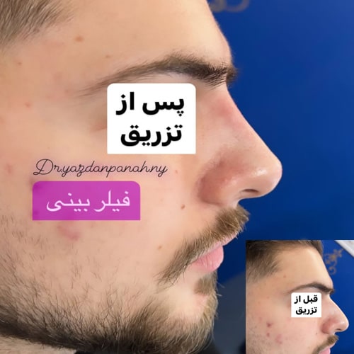 نمونه کار دکتر نادر یزدان پناه