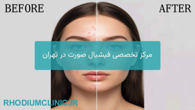 بهترین مرکز فیشیال در تهران