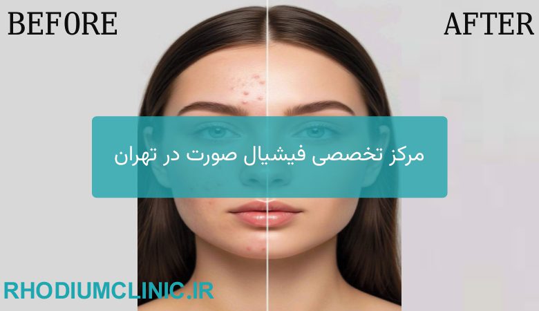 بهترین مرکز فیشیال در تهران