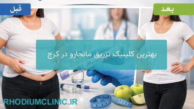 تزریق مانجارو در کرج