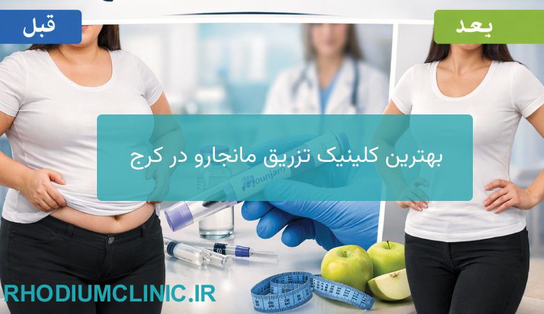 تزریق مانجارو در کرج