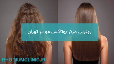 بهترین مرکز بوتاکس مو در تهران