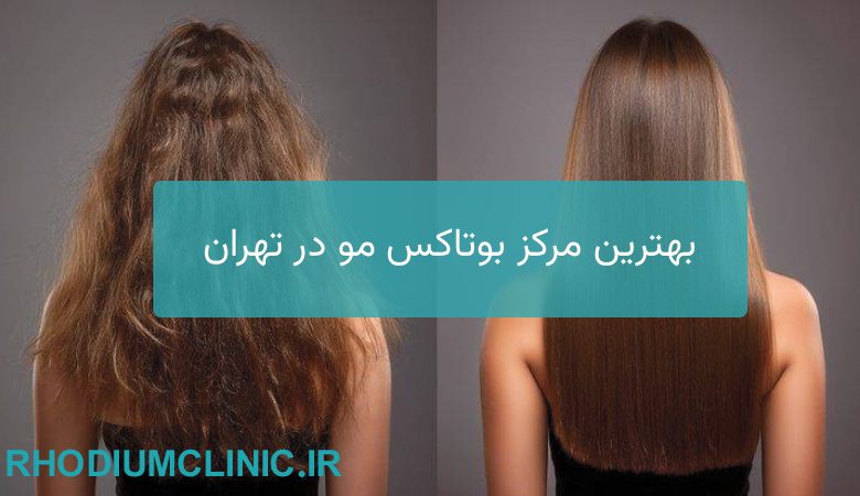 بهترین مرکز بوتاکس مو در تهران